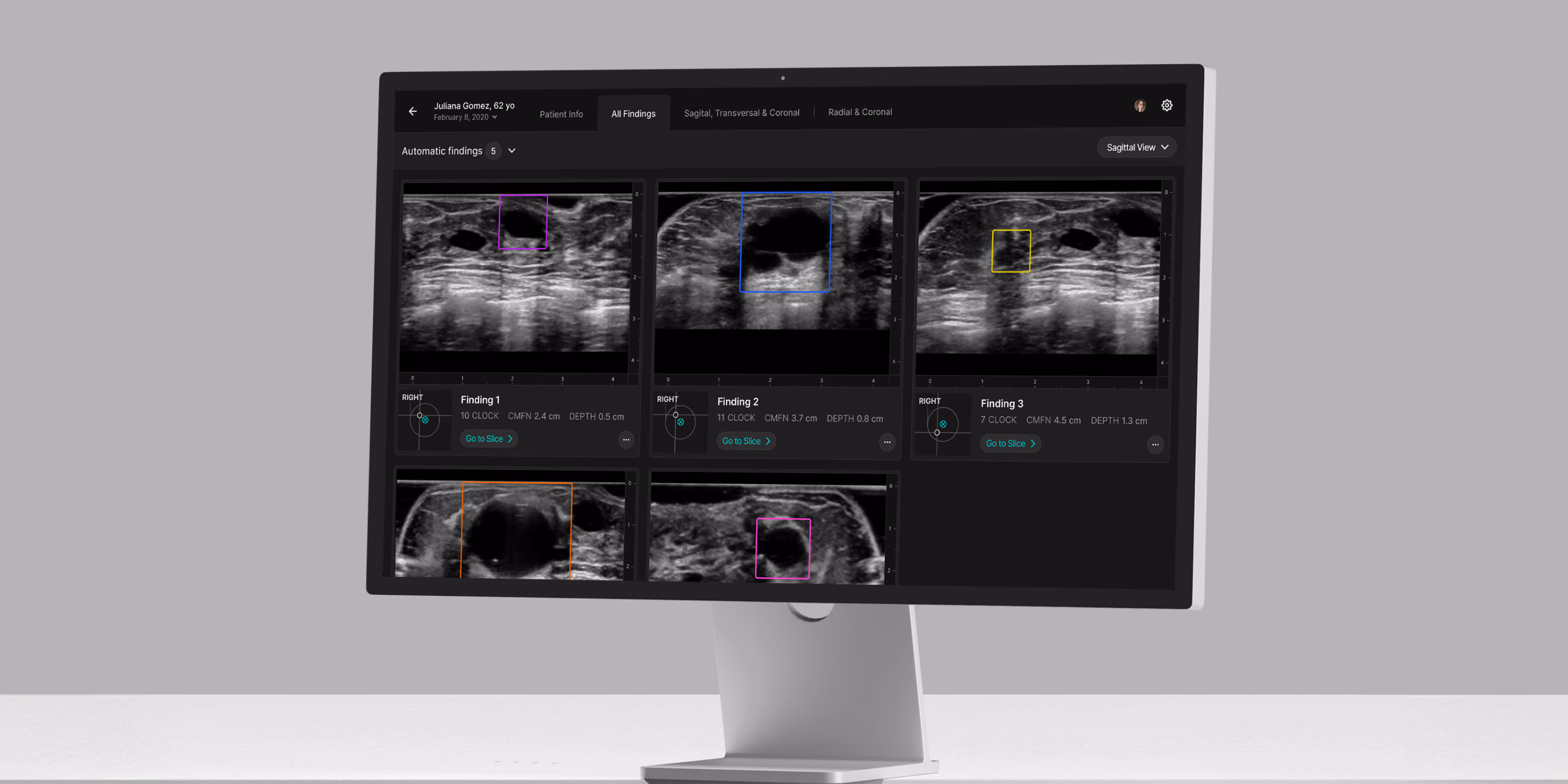 Over 8 weeks, we collaborated with iSono to develop new strategies to evolve ATUSA, an breast ultrasound scanner for cancer detection. 