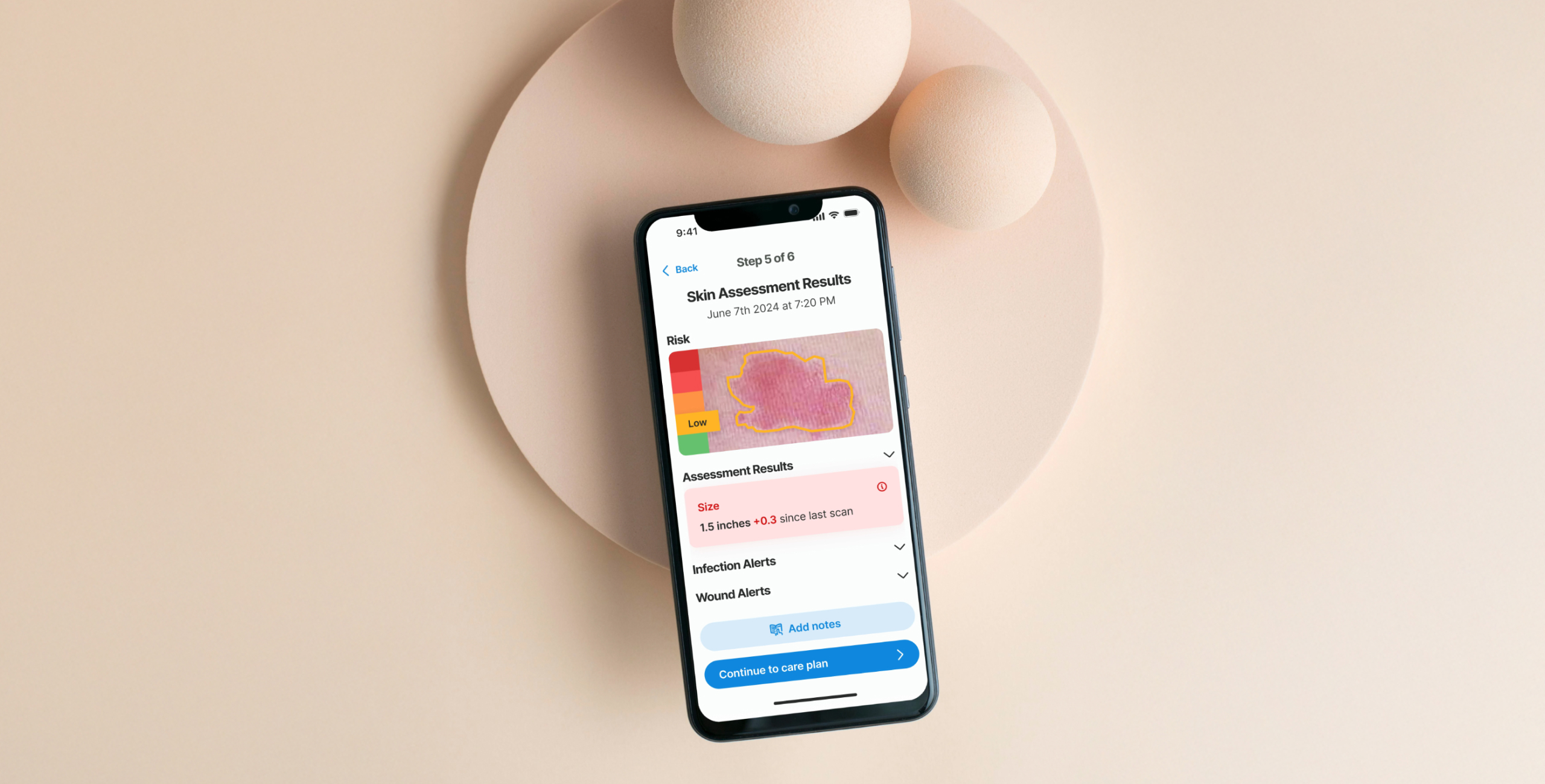 App interface for early detection and prevention of bedsores using AI technology.
